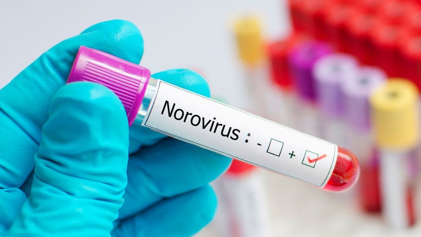 Norovirus