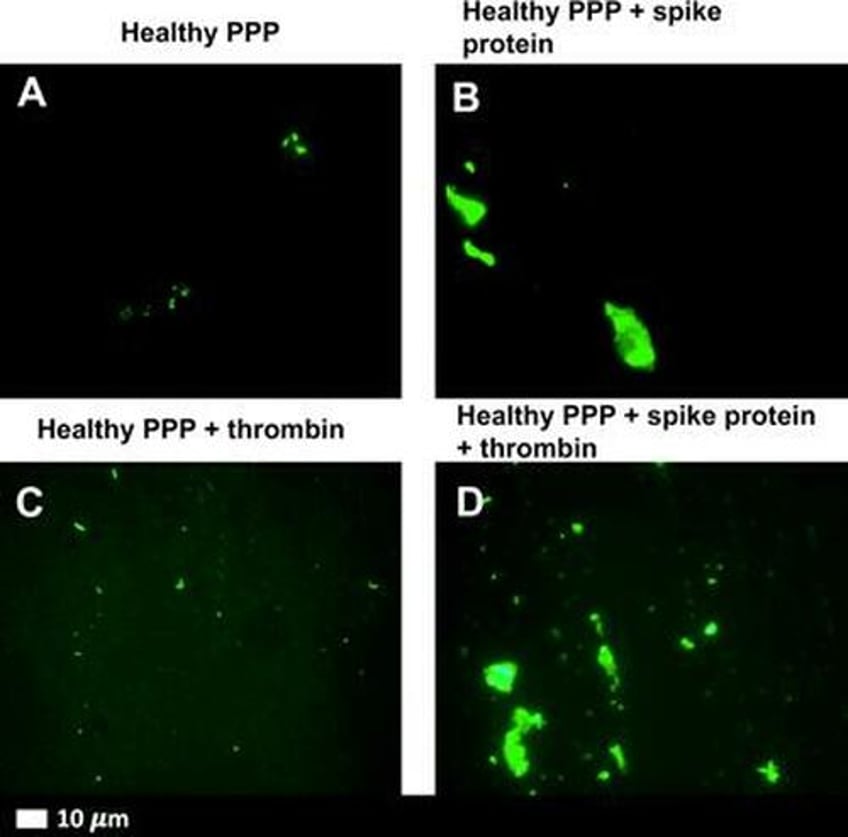 a deeper dive into the role of spike protein in myocarditis and blood clotting after covid 19 vaccination