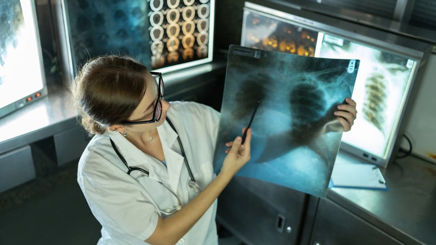 ai model could help predict lung cancer risks in non smokers study finds significant advancement