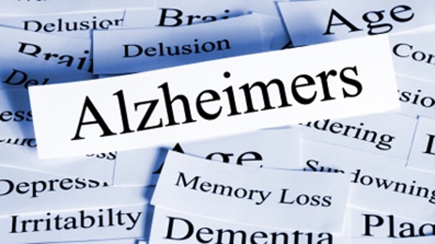 A conceptual look at Alzheimers disease, and some of the problems it brings.