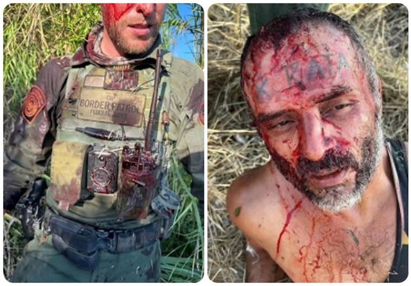 alleged cartel informer brutally assaults bites border patrol agent in texas