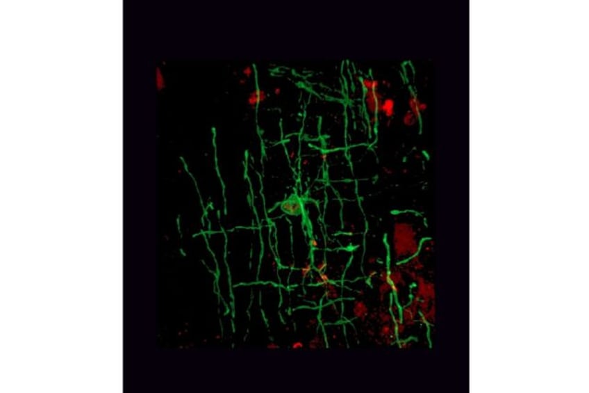 An oligodendrocyte, a type of cell responsible for myelin in the central nervous system, s