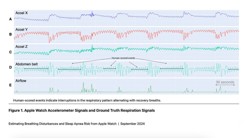 apple sleep apnea 5