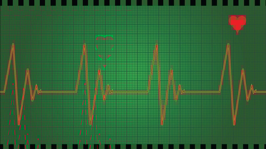 ask a doc when should i worry about heart palpitations