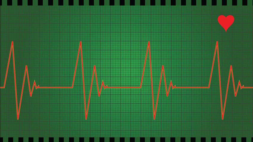 ask a doc when should i worry about heart palpitations