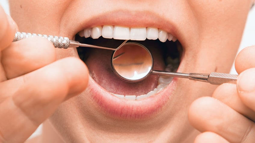 dental exam