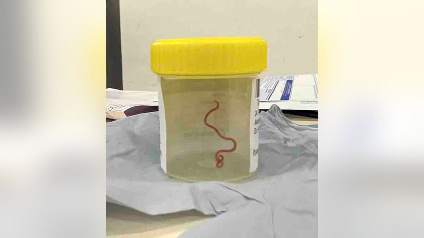 australian neurosurgeon finds parasitic worm in womans brain while investigating mystery illness