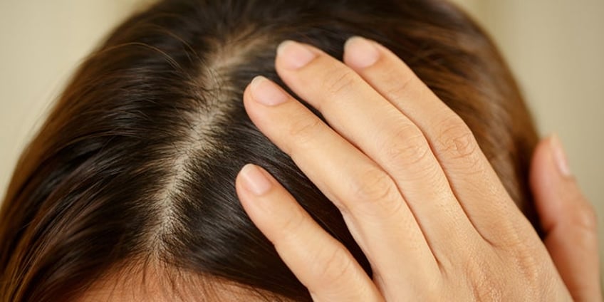 bad hair day study shows you might want to blame your relatives family