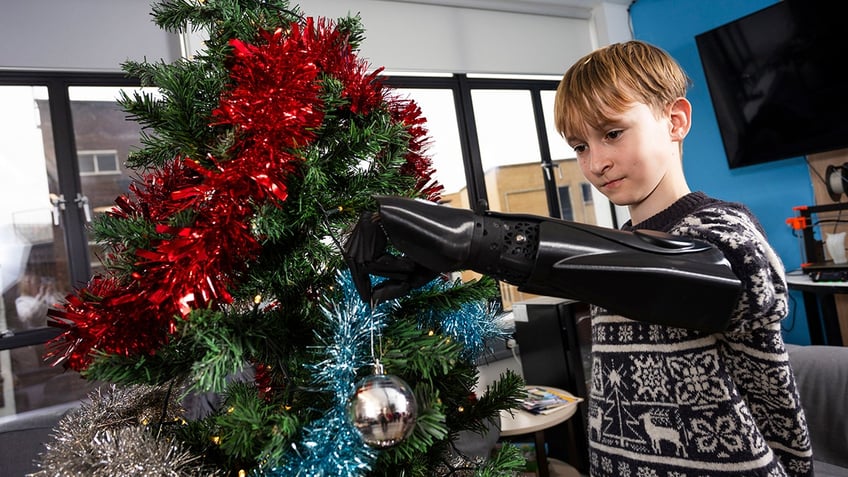 boy with bionic arm holding ornament