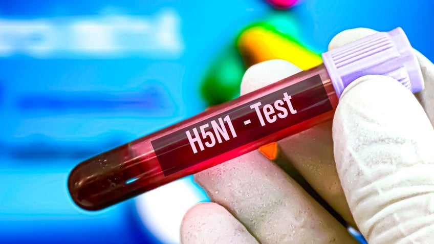 H5N1 test