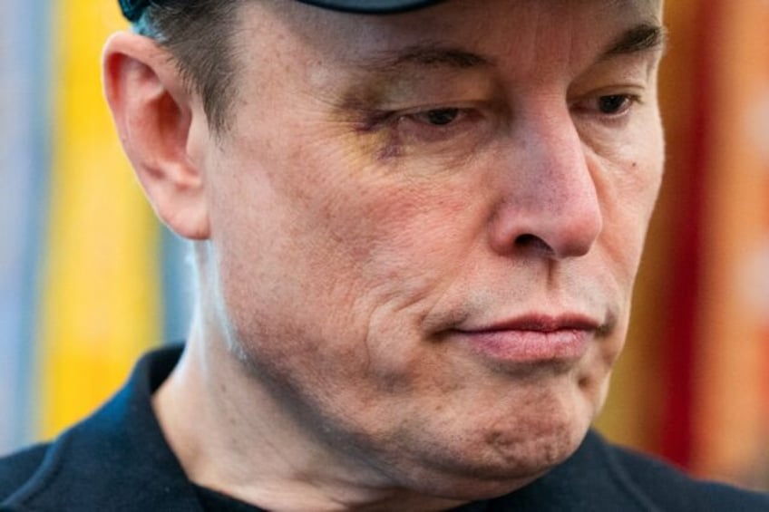 Elon Musk showed up to the Oval Office press conference sporting a bruise around his right