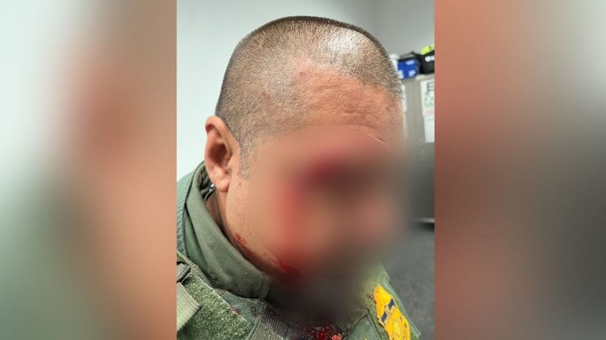 Image of a Border Patrol agent's bloody face