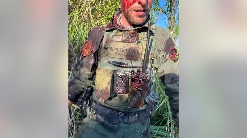 border patrol agent attacked by suspected migrant smuggler with rata meaning rat tattoo on forehead