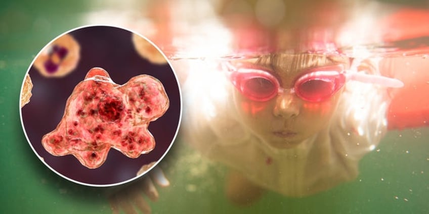 brain eating amoebas what you must know about the risk of swimming in fresh water