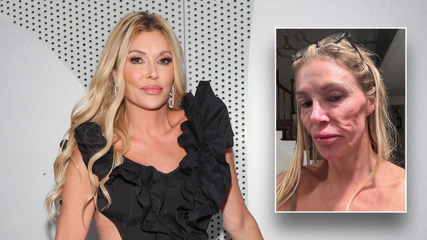 Brandi Glanville in a black ruffly dress pouts on the carpet inset a photo of her face looking weirdly shaped by a parasite