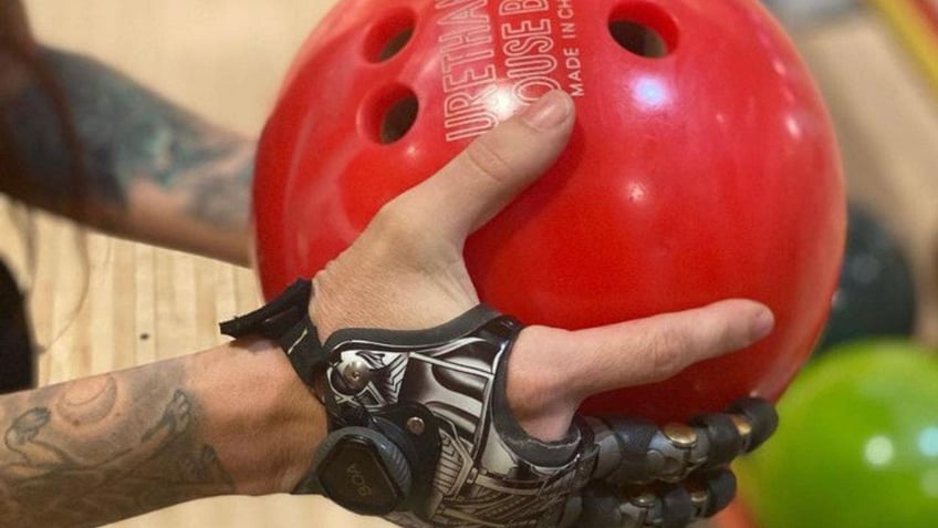 breakthrough prosthetic fingers revolutionize the lives of amputees