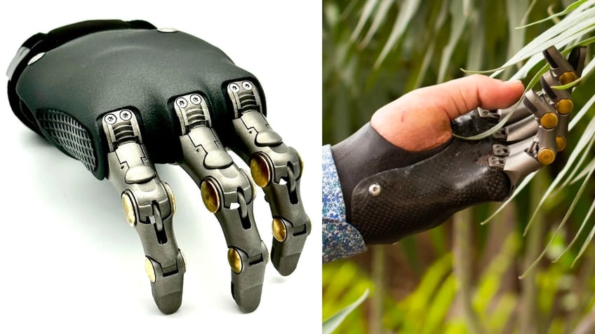 breakthrough prosthetic fingers revolutionize the lives of amputees