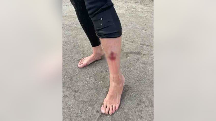 california surfer suffers bite to leg in reported shark attack