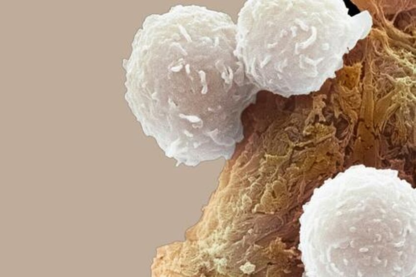 cancer cells cooperate to survive study finds