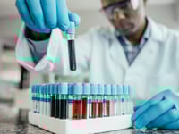 Cancer could be detected three years before diagnosis with experimental blood test