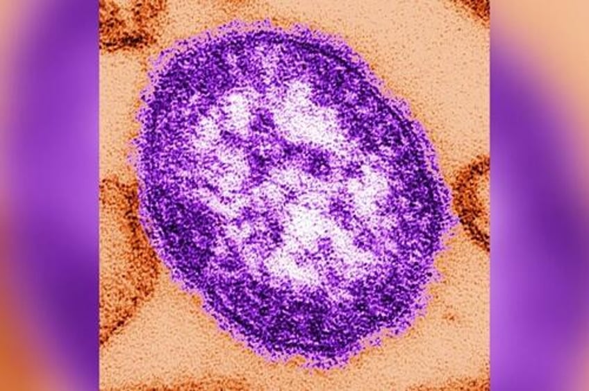 cdc measles cases in us so far this year already triple 2023 total