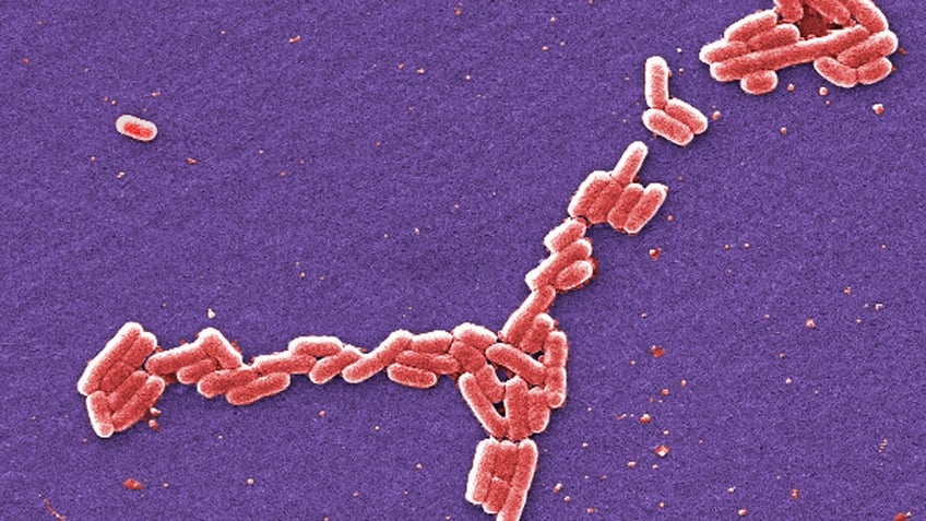 E. coli