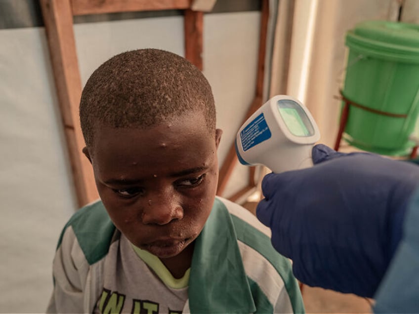 A patient has his temperature taken at the Mpox treatment centre at Nyiragongo General Ref