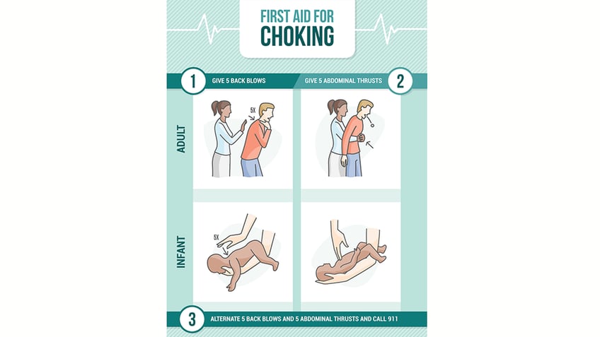 Heimlich maneuver guide