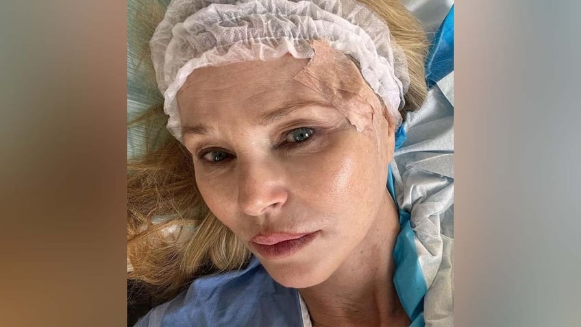 Christie Brinkley after having skin cancer removed