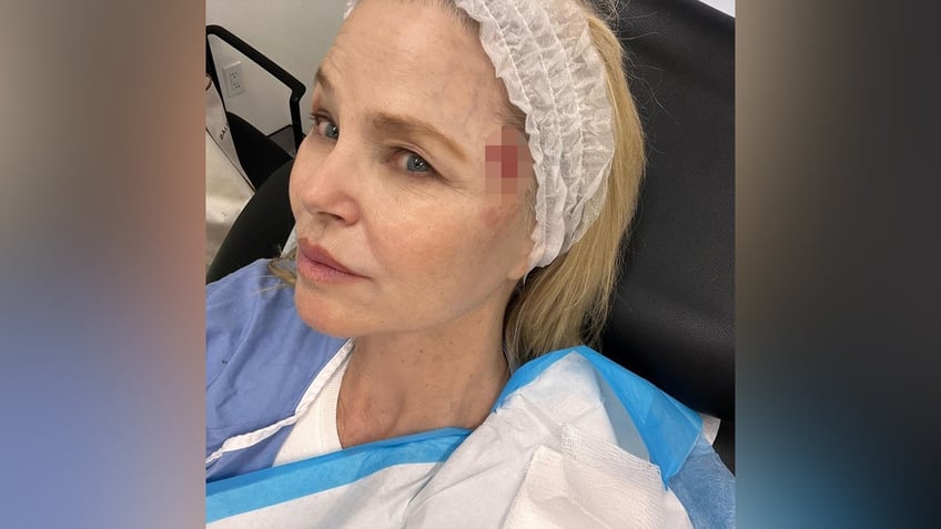 Christie Brinkley bloody cancer removal