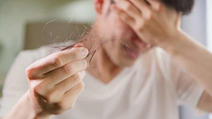 man holding fallen hair in hand 