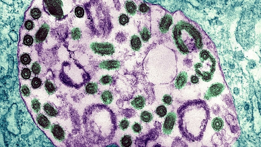 Marburg virus