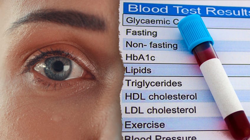 Vision cholesterol split