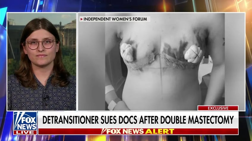 detransitioner files 1m lawsuit against doctors for botched mastectomy that left her permanently disfigured