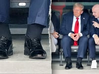 Doctors react to alleged Trump health concerns as photos show swelling and bruising