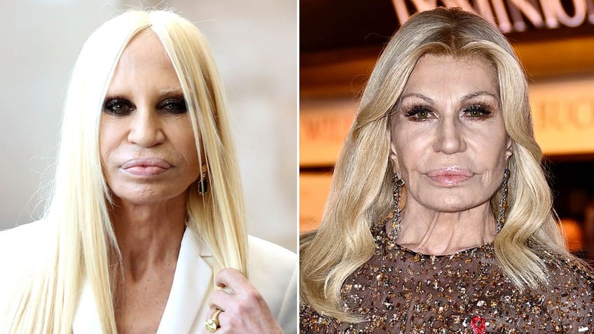 side by side of Donatella Versace in 2014 and 2024