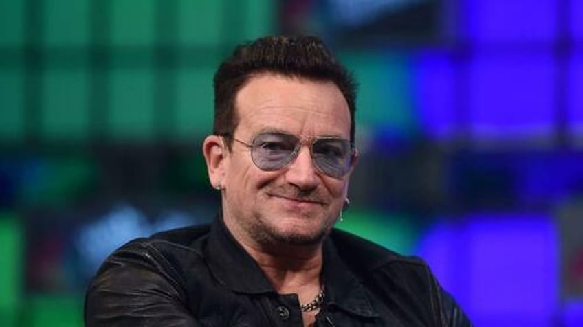 elon musk bono is a retard
