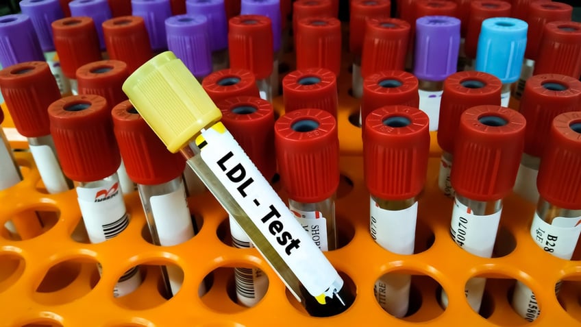 LDL cholesterol