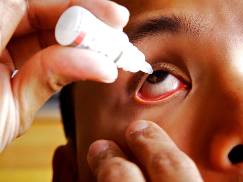 fda recalls 27 eye drops made at india factory where workers go barefoot