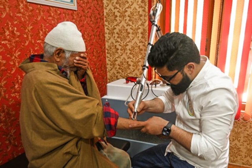 Basit Bashir, a tattoo removal artist, uses a laser machine to remove tattoos from the arm