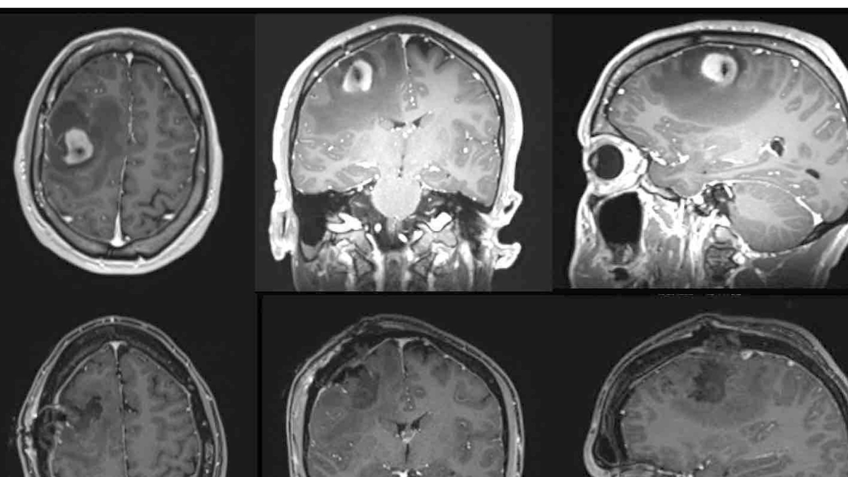 Christian Nolen's brain scans