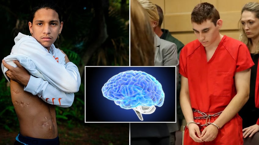 Man shows scars next to image of brain scan.