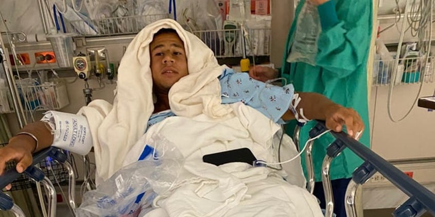 florida surfer attacked by shark credits friend for life saving rescue could have been way worse