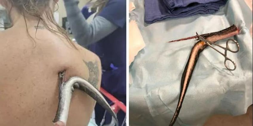 florida woman impaled by stingray while wading at beach certain that i was going to die