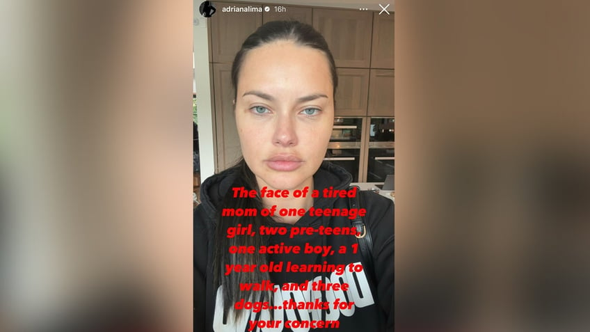 former victorias secret model adriana lima responds to plastic surgery accusations