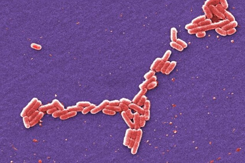 four students hospitalized in e coli outbreak at the university of arkansas