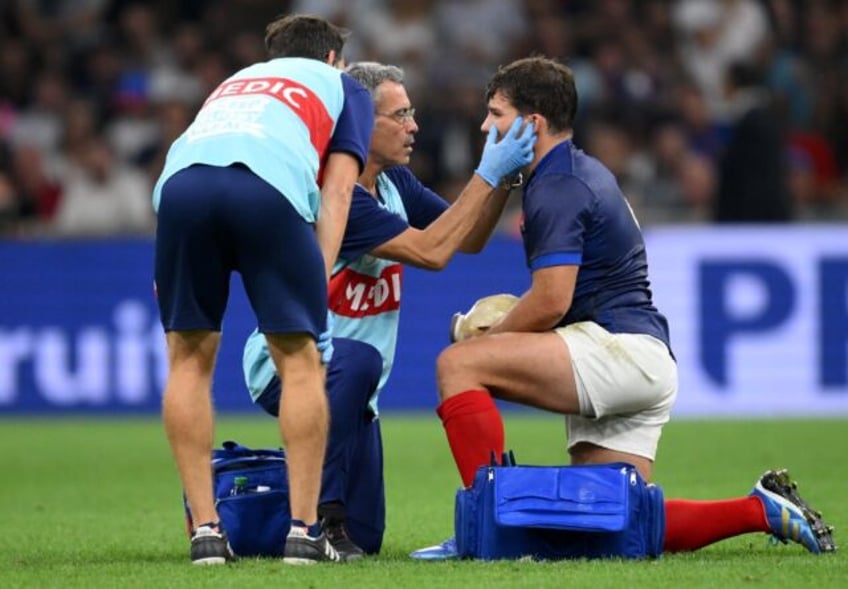 france captain dupont has surgery on fractured cheekbone