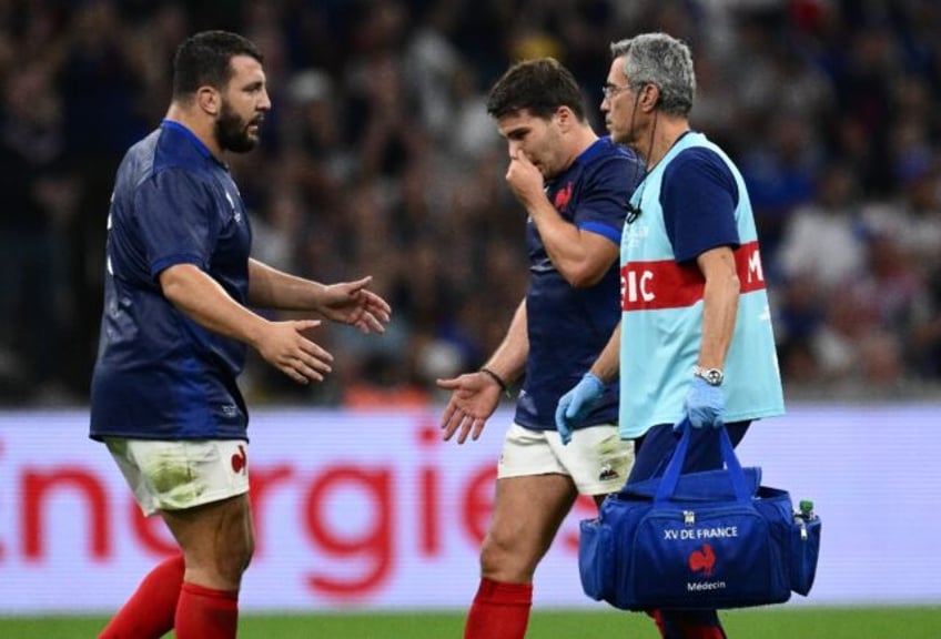 france star dupont has suspected broken jaw coach galthie