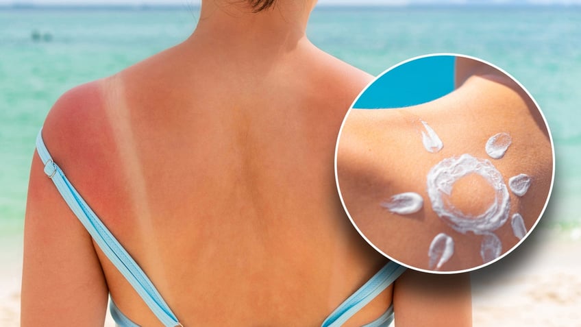 A person with sunscreen on back and a picture in a circle inset of sunscreen applied to body in the shape of a sun