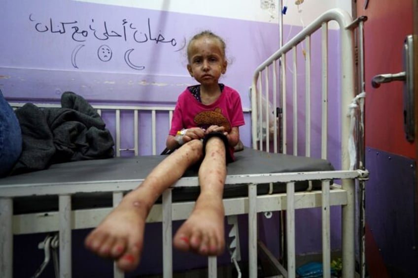 A Palestinian child awaits malnourishment treatment at Al-Aqsa Martyrs Hospital on May 30,